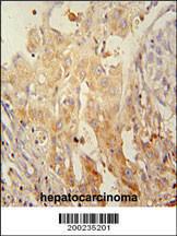 Anti-PINK1 Mouse Monoclonal Antibody [clone: 38CT20.8.5]