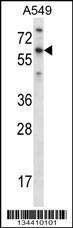 Anti-TBX21 Rabbit Polyclonal Antibody (HRP (Horseradish Peroxidase))