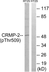 Western blot analysis of lysates from HT29 cells treated with heat shock using Anti-CRMP-2 (phospho Thr509) Antibody. The right hand lane represents a negative control, where the antibody is blocked by the immunising peptide