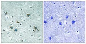 Immunohistochemical analysis of paraffin-embedded human brain using Anti-CRMP-2 (phospho Thr509) Antibody. The right hand panel represents a negative control, where the antibody was pre-incubated with the immunising peptide