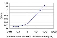 Anti-SNAPC5 Mouse Monoclonal Antibody [clone: 5C3]