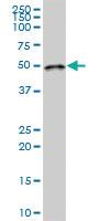 Anti-LPCAT2 Mouse Polyclonal Antibody