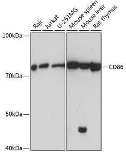 Western blot analysis of extracts of various cell lines, using Anti-CD86 Antibody [ARC0333] (A307160) at 1:1,000 dilution. The secondary antibody was Goat Anti-Rabbit IgG H&L Antibody (HRP) at 1:10,000 dilution.