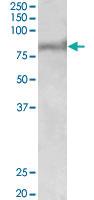 Anti-ABCD2 Goat Polyclonal Antibody