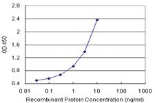 Anti-SERPINB1 Polyclonal Antibody Pair