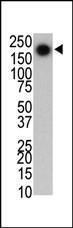 Anti-LRRK2 Mouse Monoclonal Antibody (HRP (Horseradish Peroxidase)) [clone: 133AT1218]