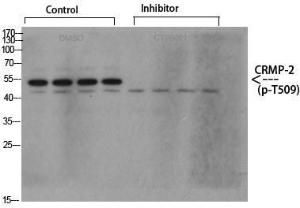 Western blot analysis of various cells using Anti-CRMP-2 (phospho Thr509) Antibody at 1:1,000 (4°C overnight). Goat Anti-Rabbit IgG (IRDye 800) was used as a secondary at 1:5,000 (25°C, 1 hour)