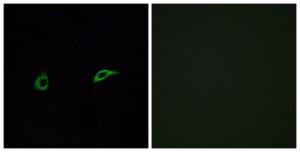 Immunofluorescence analysis of A549 cells using Anti-OR2C1 Antibody. The right hand panel represents a negative control, where the antibody was pre-incubated with the immunising peptide