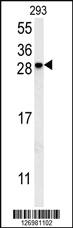 Anti-C5orf15 Rabbit Polyclonal Antibody