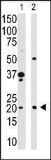 Anti-HPCA Rabbit Polyclonal Antibody (Biotin)