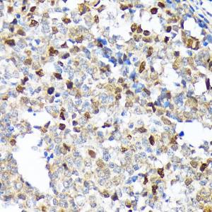 Immunohistochemistry analysis of paraffin-embedded human appendix tissue using Anti-KIFC1 Antibody [ARC1808] (A307161) at a dilution of 1:100 (40x lens) Perform microwave antigen retrieval with 10 mM Tris/EDTA buffer pH 90 before commencing with IHC staining protocol