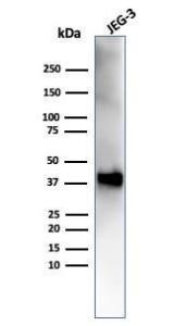 Anti-SPARC antibody