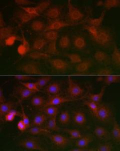 Immunofluorescence analysis of C6 cells using Anti-SSR2 Antibody (A305691) at a dilution of 1:100 (40X lens). DAPI was used to stain the cell nuclei (blue)