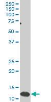 Anti-SNAPC5 Mouse Monoclonal Antibody [clone: 5E2]