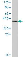 Anti-RAC2 Mouse Monoclonal Antibody [clone: 3B10-2D9]