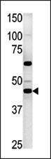 Anti-PGK2 Rabbit Polyclonal Antibody (HRP (Horseradish Peroxidase))