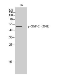 Western blot analysis of JK cells using Anti-CRMP-2 (phospho Thr509) Antibody