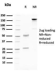 SDS-PAGE analysis of Anti-Desmoglein 3 Antibody [DSG3/2796] under non-reduced and reduced conditions; showing intact IgG and intact heavy and light chains, respectively. SDS-PAGE analysis confirms the integrity and purity of the antibody.