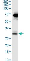 Anti-STC2 Mouse Monoclonal Antibody [clone: 2B11]