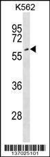 Anti-EYA2 Rabbit Polyclonal Antibody (HRP (Horseradish Peroxidase))