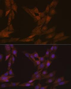 Immunofluorescence analysis of NIH-3T3 cells using Anti-KIFC1 Antibody [ARC1808] (A307161) at a dilution of 1:100 (40x lens) DAPI was used to stain the cell nuclei (blue)