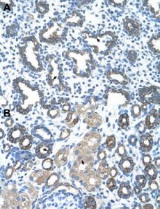 Anti-GNAS Rabbit Polyclonal Antibody