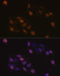 Immunofluorescence analysis of U-2 OS cells using Anti-KIFC1 Antibody [ARC1808] (A307161) at a dilution of 1:100 (40x lens) DAPI was used to stain the cell nuclei (blue)