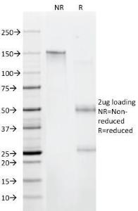 SDS-PAGE analysis of Anti-CD11 Antibody [C6/372] under non-reduced and reduced conditions; showing intact IgG and intact heavy and light chains, respectively. SDS-PAGE analysis confirms the integrity and purity of the antibody