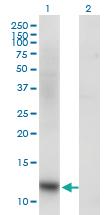 Anti-SNAPC5 Mouse Monoclonal Antibody [clone: 5E2]