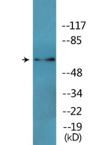 Western blot analysis of lysates from HT29 cells treated with heat shock using Anti-CRMP-2 (phospho Thr509) Antibody