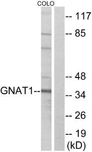 Antibody anti-GNAT1 100 µg