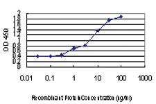 Anti-STC2 Mouse Monoclonal Antibody [clone: 2B11]