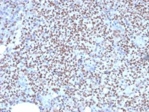 Immunohistochemical analysis of formalin-fixed, paraffin-embedded human lymph node using Anti-PU.1 Antibody [PU1/2146]