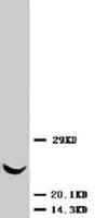 Anti-TIMP3 Rabbit Polyclonal Antibody