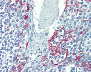 Anti-LIMD1 Rabbit Polyclonal Antibody