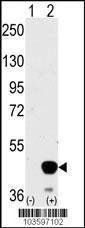 Anti-MAP2K2 Rabbit Polyclonal Antibody (HRP (Horseradish Peroxidase))