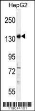 Anti-PALB2 Rabbit Polyclonal Antibody (AP (Alkaline Phosphatase))