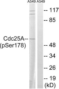 Western blot analysis of lysates from A549 cells treated with UV 15' using Anti-CDC25A (phospho Ser178) Antibody. The right hand lane represents a negative control, where the antibody is blocked by the immunising peptide