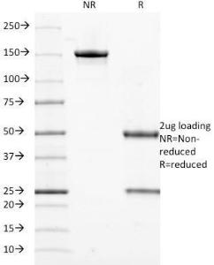 SDS-PAGE analysis of Anti-Cytokeratin 18 Antibody [DE-K18] under non-reduced and reduced conditions; showing intact IgG and intact heavy and light chains, respectively. SDS-PAGE analysis confirms the integrity and purity of the Antibody