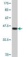 Anti-RAD54L Mouse Polyclonal Antibody