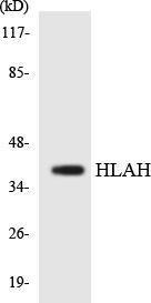 Anti-HLAH antibody