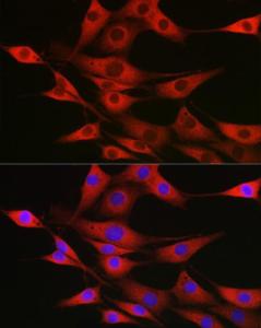 Immunofluorescence analysis of NIH/3T3 cells using Anti-SSR2 Antibody (A305691) at a dilution of 1:100 (40X lens). DAPI was used to stain the cell nuclei (blue)