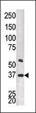 Anti-ZCCHC14 Rabbit Polyclonal Antibody