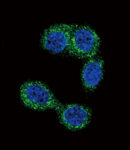 Anti-HNMT Rabbit Polyclonal Antibody (FITC (Fluorescein))