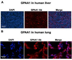 Anti-GPAA1 Rabbit Polyclonal Antibody