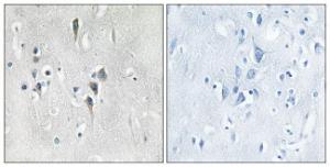 Immunohistochemical analysis of paraffin-embedded human brain tissue using Anti-CaMK2 alpha + delta Antibody. The right hand panel represents a negative control, where the antibody was pre-incubated with the immunising peptide.