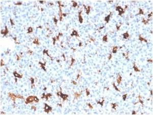 Anti-SPARC antibody