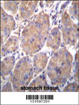 Anti-HSP90B1 Rabbit Polyclonal Antibody