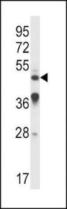 Anti-IL9R Rabbit Polyclonal Antibody (APC (Allophycocyanin))