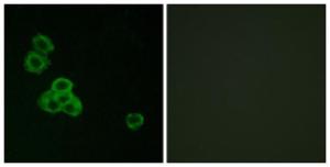 Immunofluorescence analysis of MCF7 cells using Anti-CaMK2 alpha + delta Antibody. The right hand panel represents a negative control, where the antibody was pre-incubated with the immunising peptide.